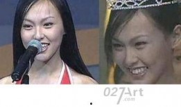 龅牙娱乐吃瓜,揭秘娱乐圈吃瓜背后的真相与笑料